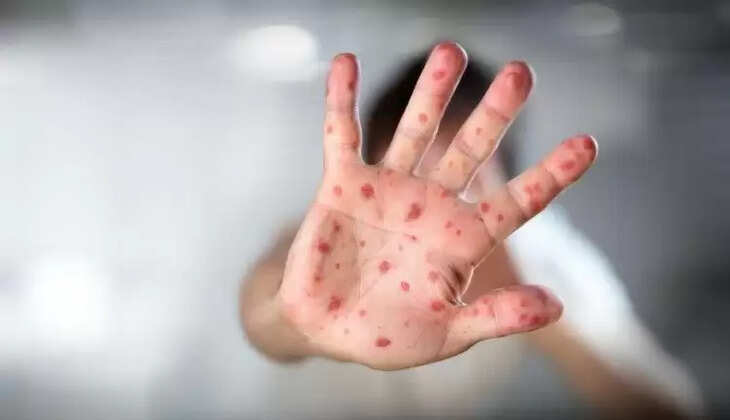 Vaccine 