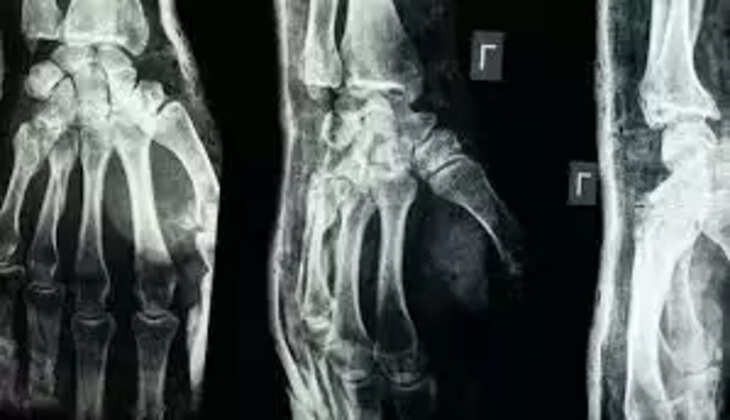bone