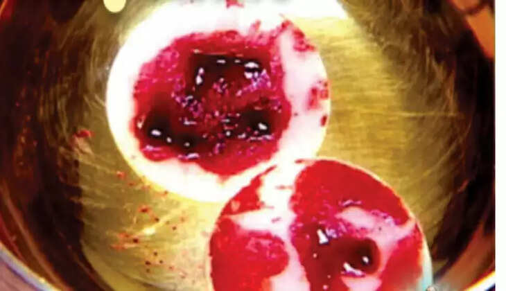 www