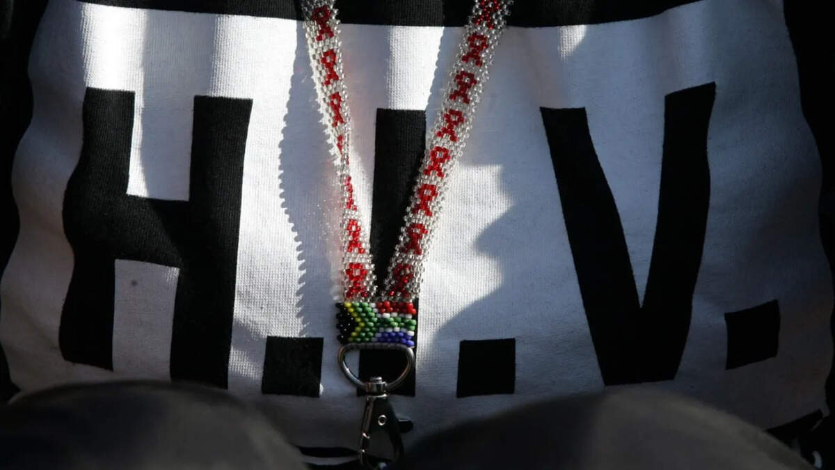 hiv